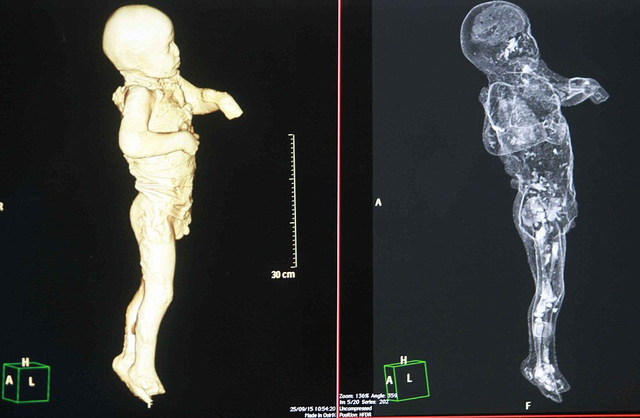 龐貝古城木乃伊接受CT掃描 死前驚恐表情曝光