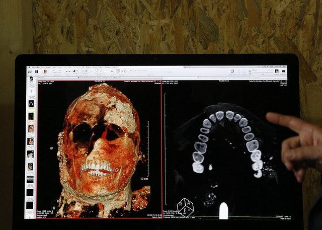 龐貝古城木乃伊接受CT掃描 死前驚恐表情曝光