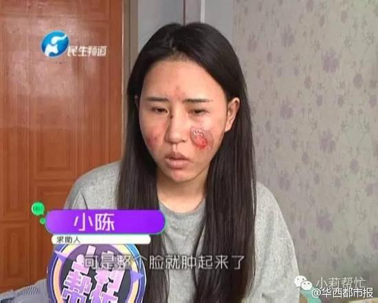 河南女子想喝水懶起床 躺著拿水壺遭燙傷毀容