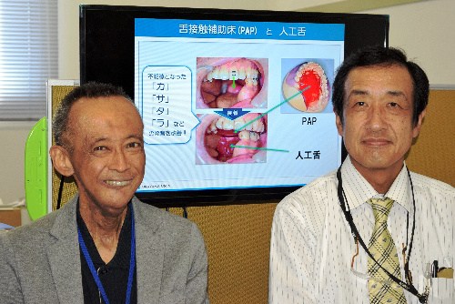 日本研發“人工舌頭” 功能全面係全球首例(圖)