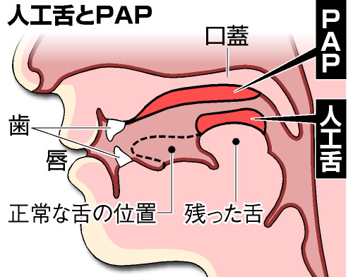 日本研發“人工舌頭” 功能全面係全球首例(圖)