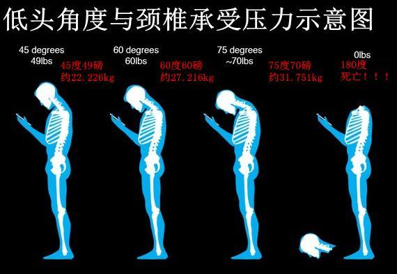 【焦點圖】【即時快訊】警惕“手機脖”！長時間玩手機的正確姿勢，你get到了嗎？