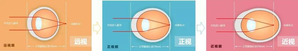 【教育頻道】國家兒童醫學中心北京兒童醫院眼科主任李莉：愛眼護眼 從小抓起