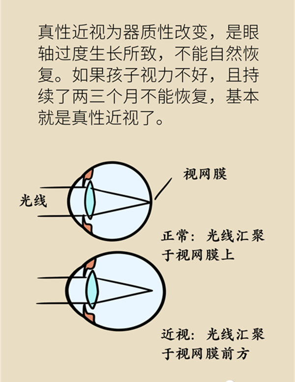 孩子近視了還能恢復正常嗎？5招教你延緩度數增長