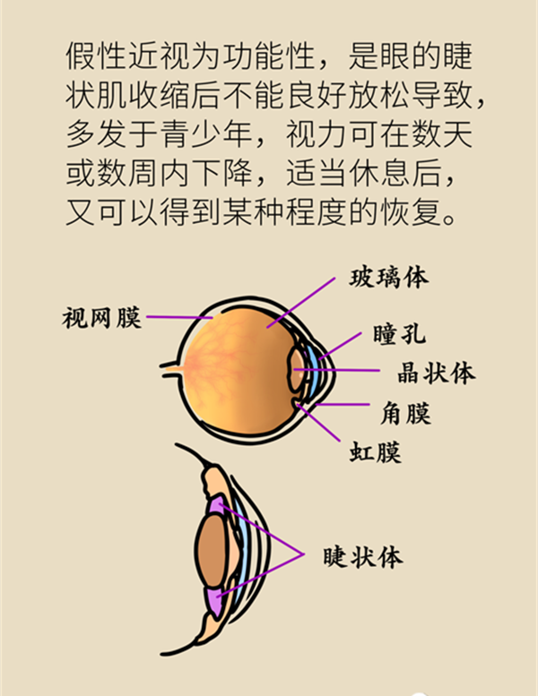 孩子近視了還能恢復正常嗎？5招教你延緩度數增長