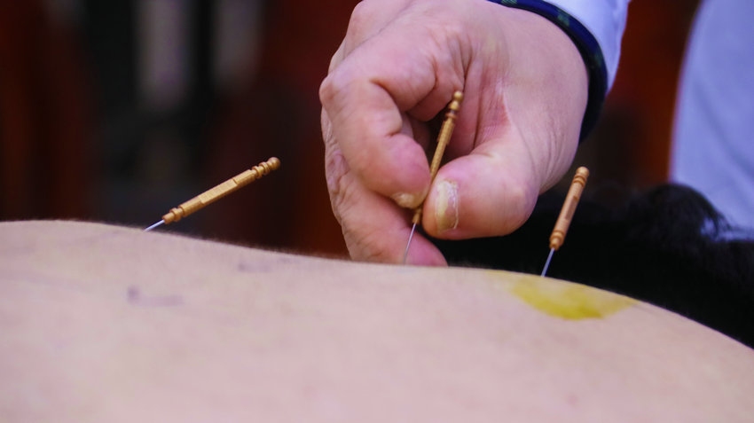 河南南陽:千年藥都煥新彩 中醫藥傳承創新譜華章_fororder_吳軍瑞在給學生講解針灸.JPG