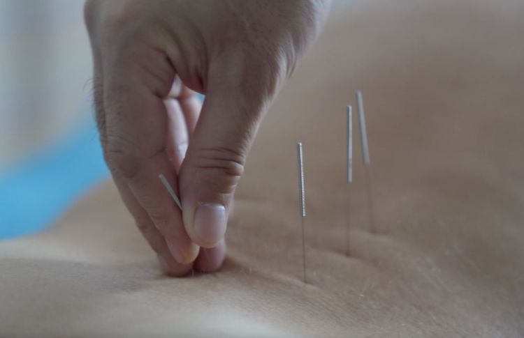 邊境小城興起旅遊熱 俄羅斯遊客被中醫“圈粉”