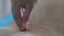 邊境小城興起旅遊熱 俄羅斯遊客被中醫“圈粉”