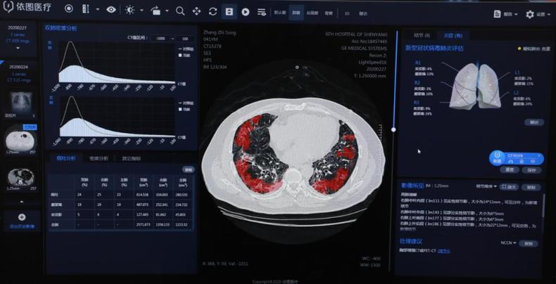 病情評估短至3秒 瀋陽市第六人民醫院啟動新冠病毒肺炎智慧評價系統