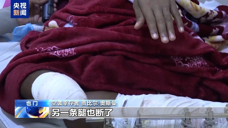 總臺探訪丨非洲移民拘留所遭襲 倖存者回憶“失去雙腿”的絕望時刻