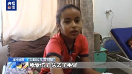 聯合國機構：加沙地帶是現代歷史上兒童截肢人數最多的地區