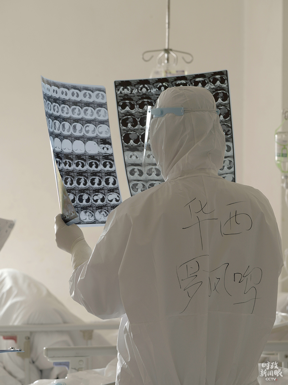 時政新聞眼丨在一場罕見的電視電話會上，習近平這樣動員戰“疫”