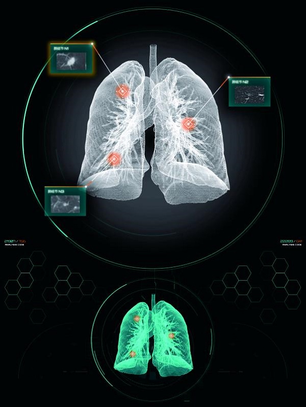 依圖醫療發佈全球首個基於醫療AI技術的癌症篩查智慧診療平臺