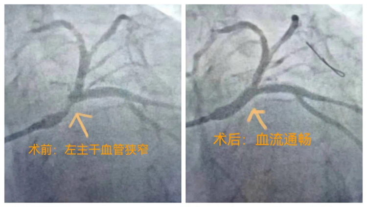 （轉載）西安大興醫院：5G加持，看心內科如何“速”效救“心”