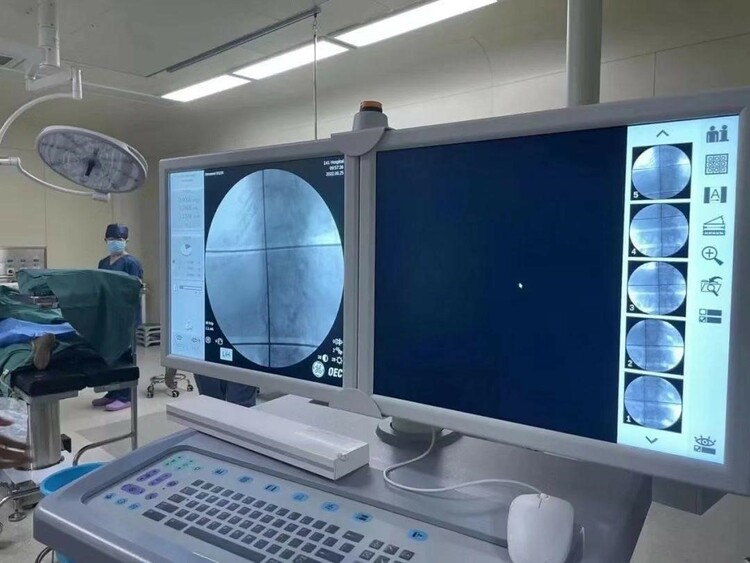 （轉載）94歲奶奶久治難愈“糖足” 西安交大一附院東院區脊髓神經電刺激術除病痛