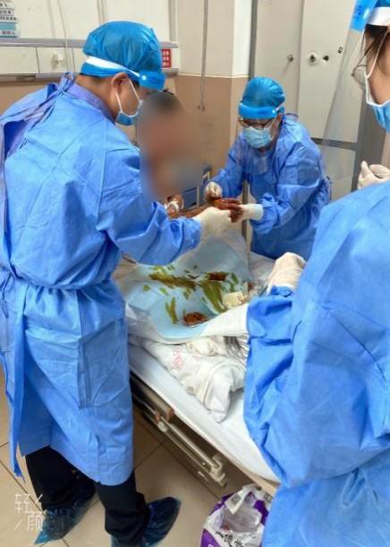 （轉載）西安交大一附院感染科成功救治近二十年來收治的首例炭疽病患者