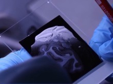 中國腦圖譜研究系列成果集中發佈 珍貴數據供國內外學者研究