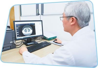 影像上雲端  數據加速跑（健康焦點）