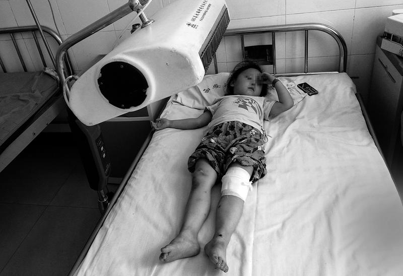【今日看點】小區用燒鹼水清洗路面 3名幼童摔倒被灼傷